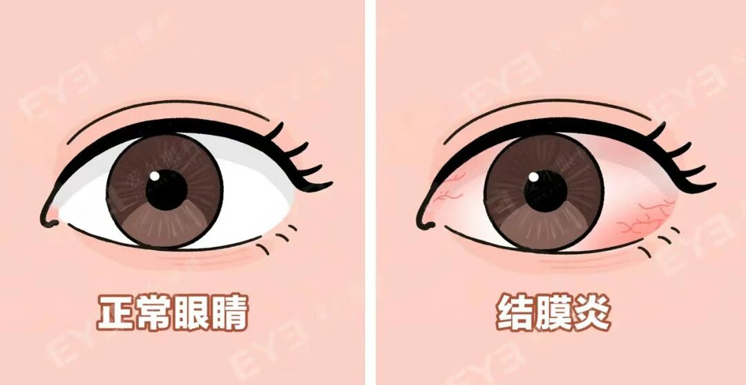 圖片.png